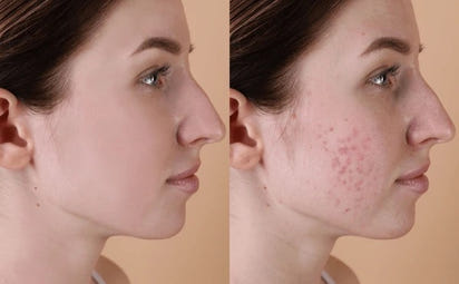 Ultra Glow Hydrating Serum