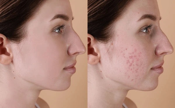 Ultra Glow Hydrating Serum
