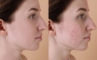 Ultra Glow Hydrating Serum